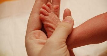 Dry Skin In Babies: Causes, Symptoms And Ways To Prevent