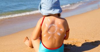 Sunburn In Babies: Signs, Treatment And Prevention SunBurn In Babies