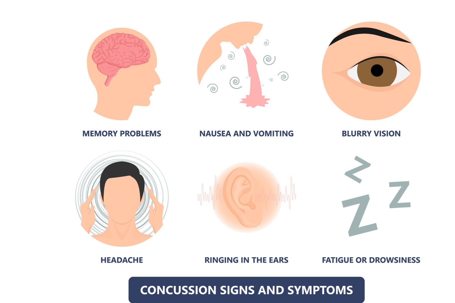 Concussion Symptoms in Children