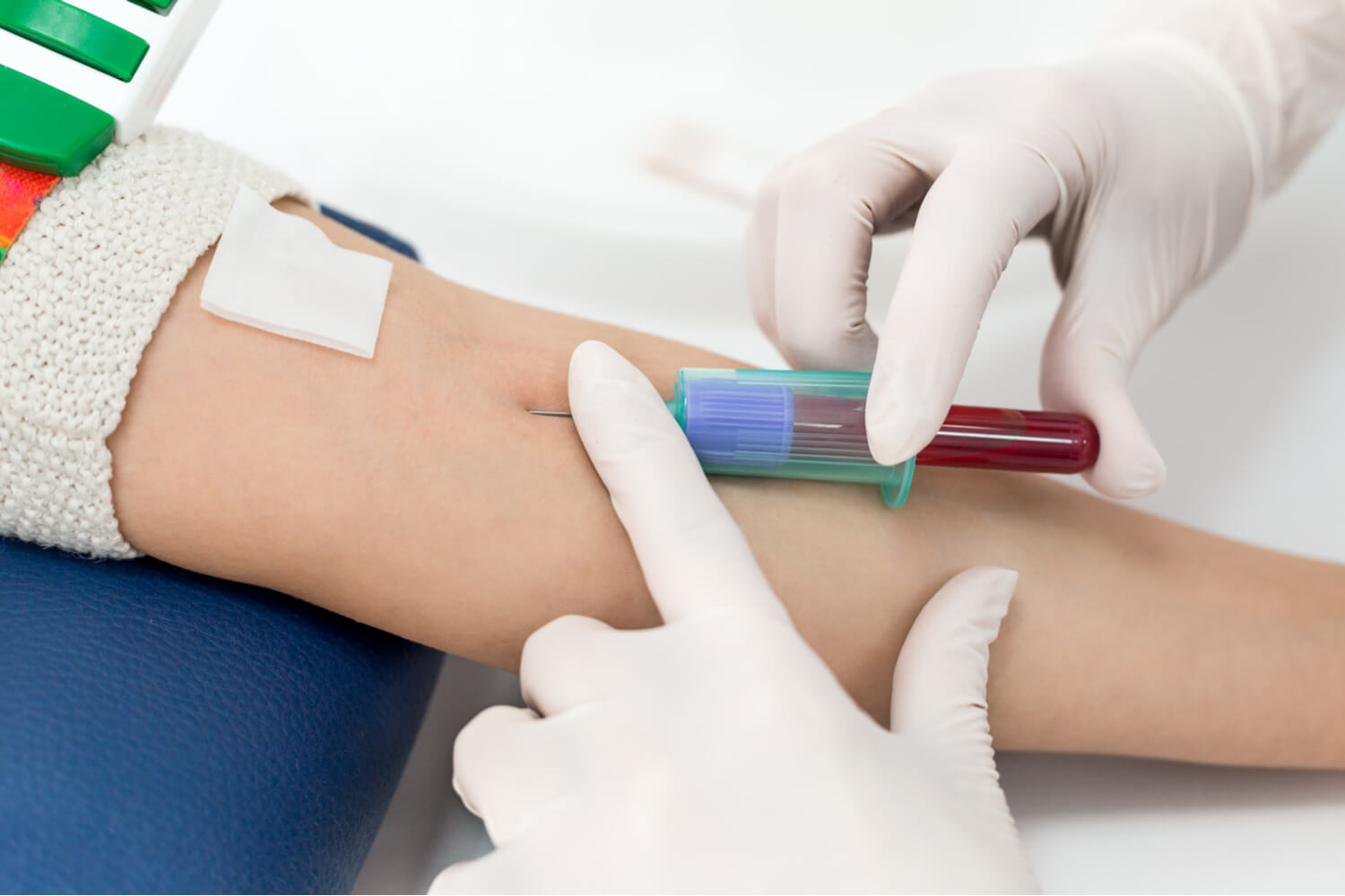 Blood Test to Confirms Pregnancy