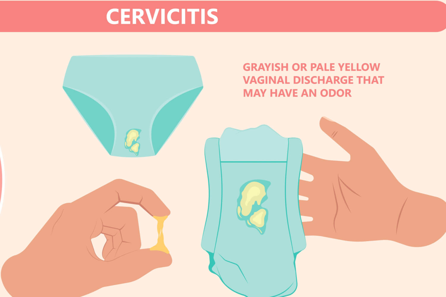 Cervical Mucus Method