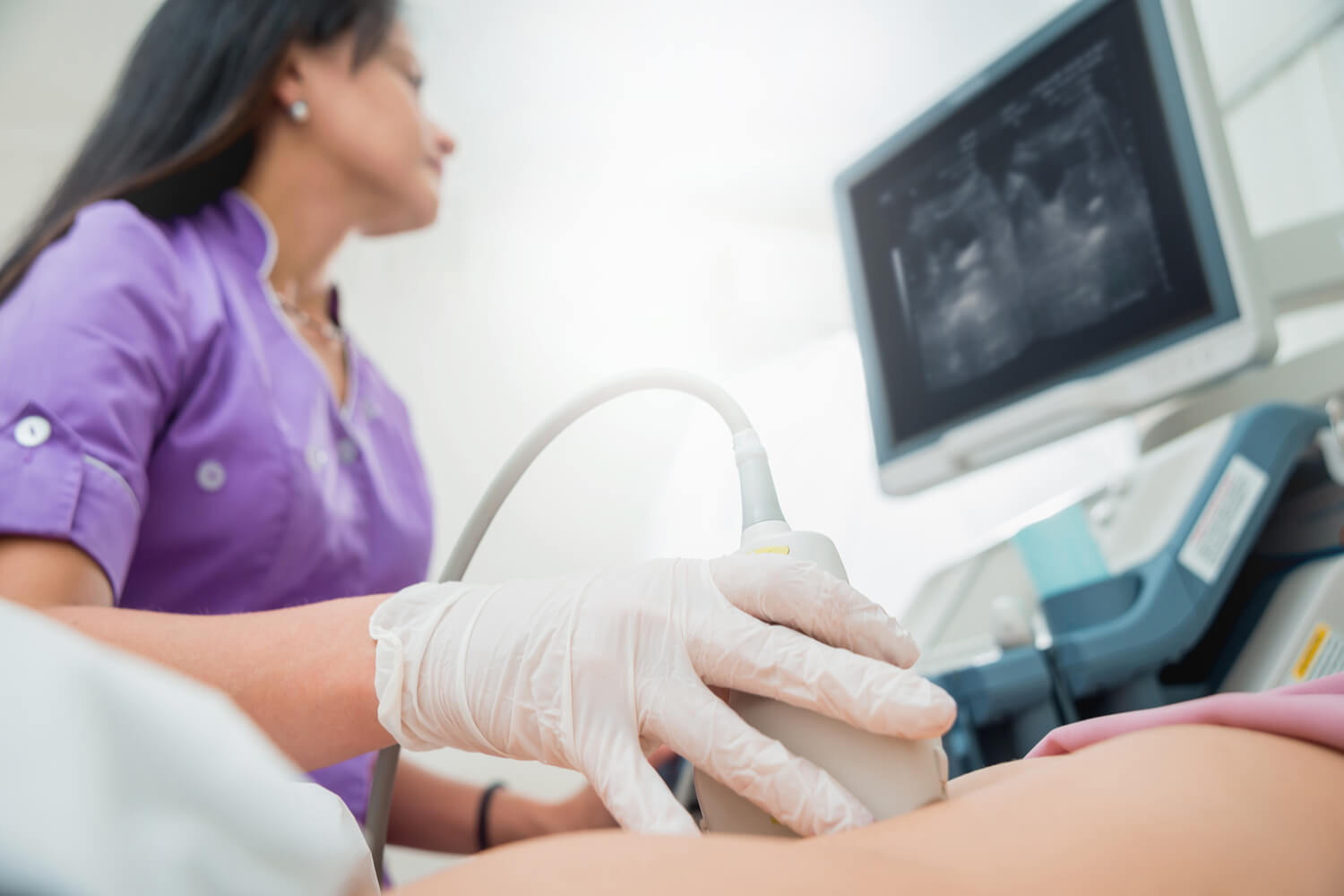 women getting ultrasound done