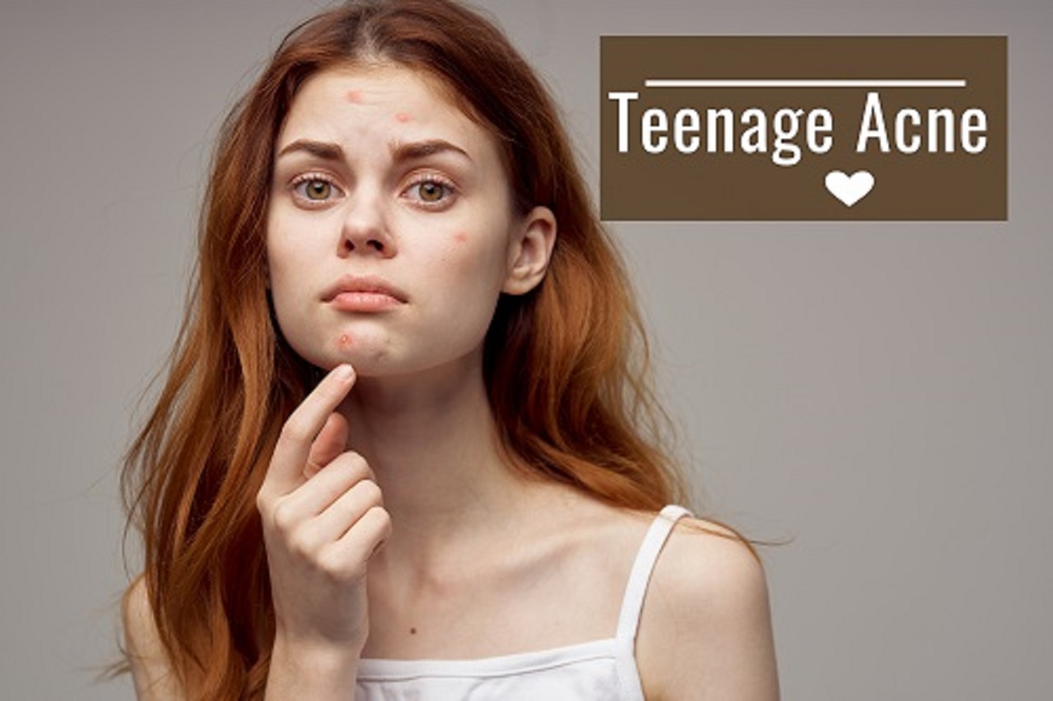 Teenage Acne and Home Remedies