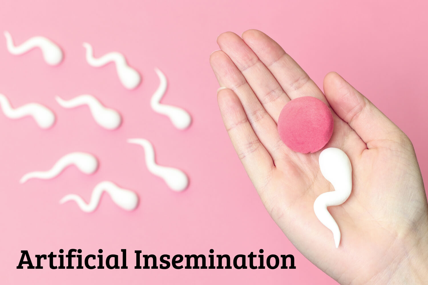 Artificial Insemination.