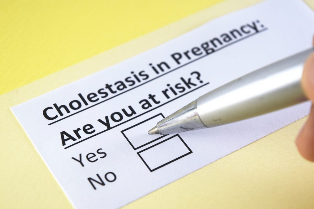 Cholestasis risk