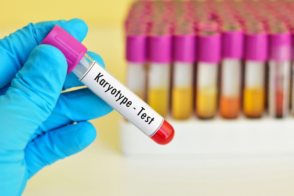Karyotype test