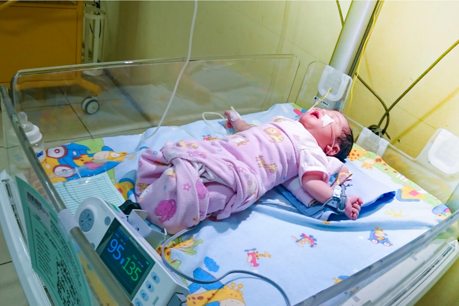 epilepsy in infants