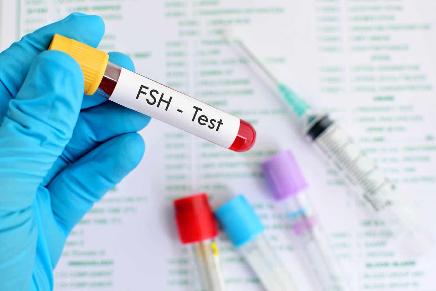blood sample for FSH test