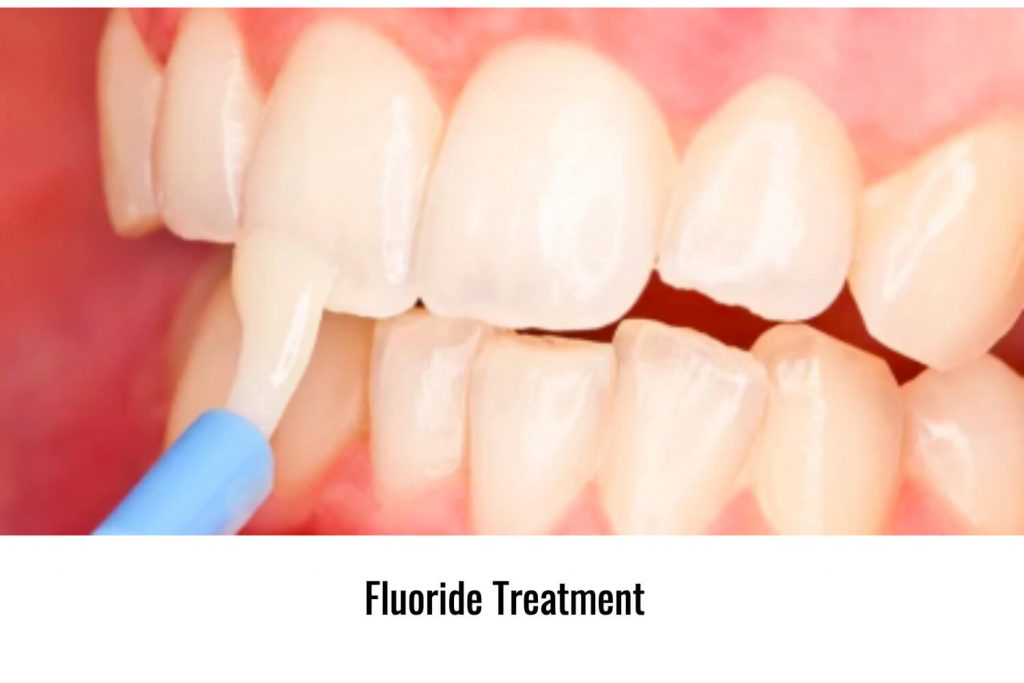 Common Procedures in Pediatric Dentistry Being The Parent