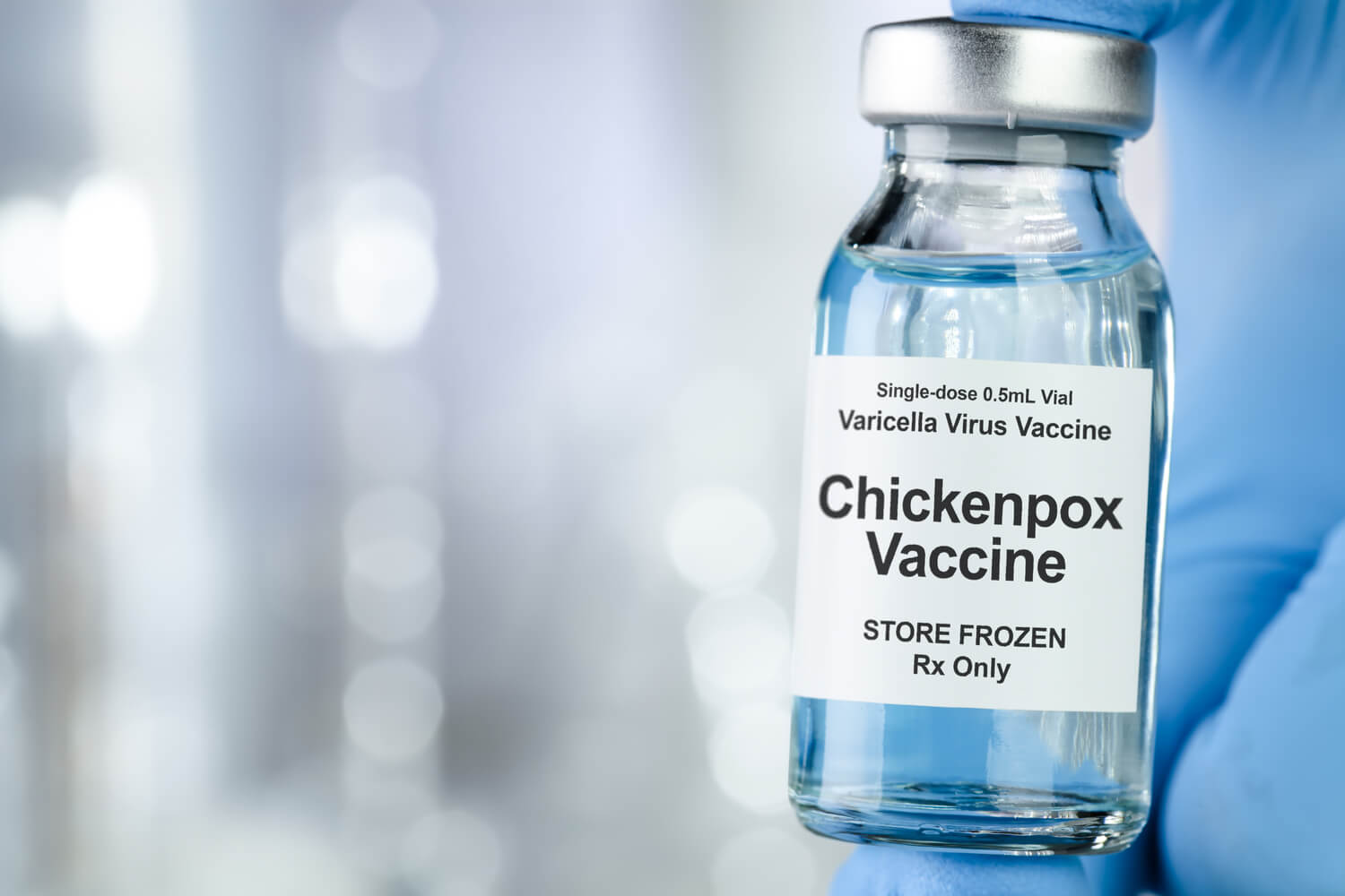 Chickenpox and its Vaccine for Babies - Being The Parent