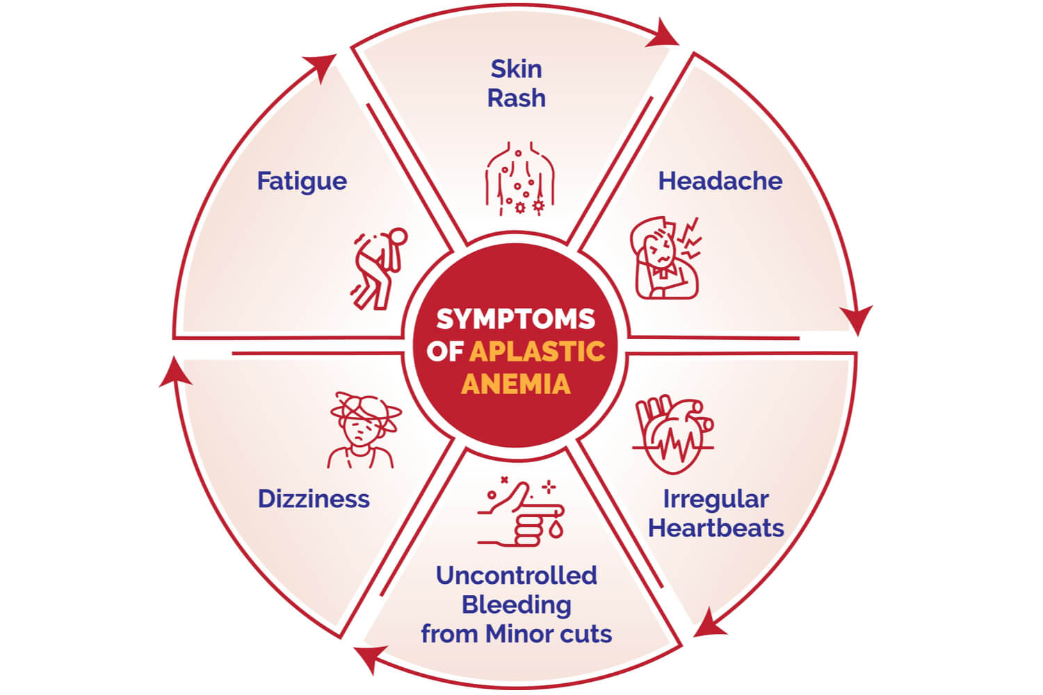 Anemia aplastic