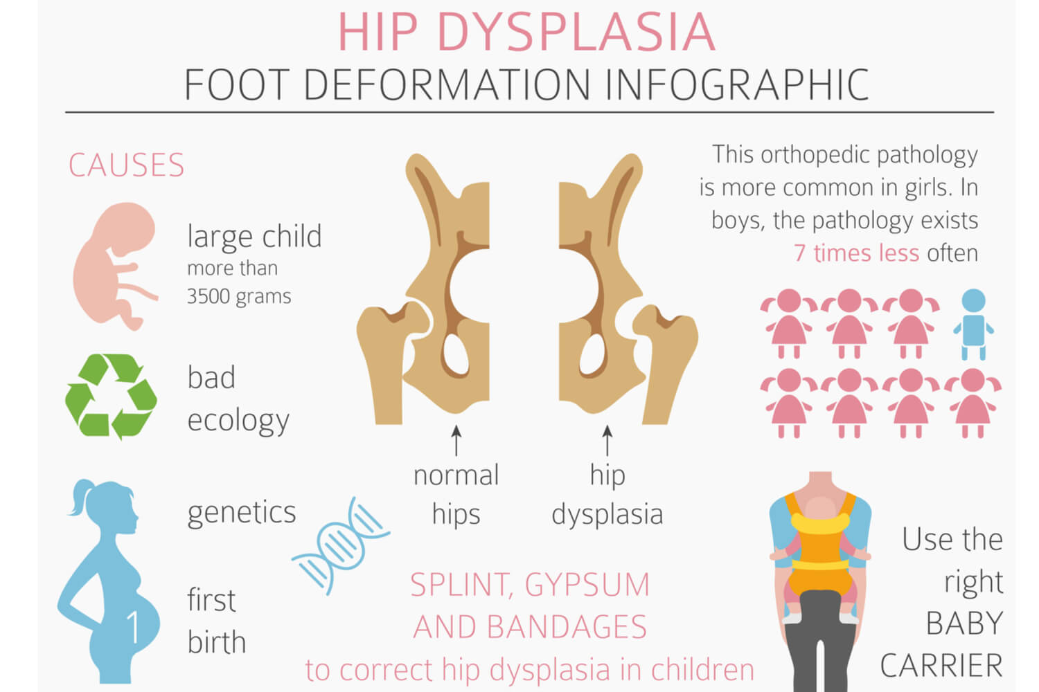 Clicky Hips in Babies Being The Parent