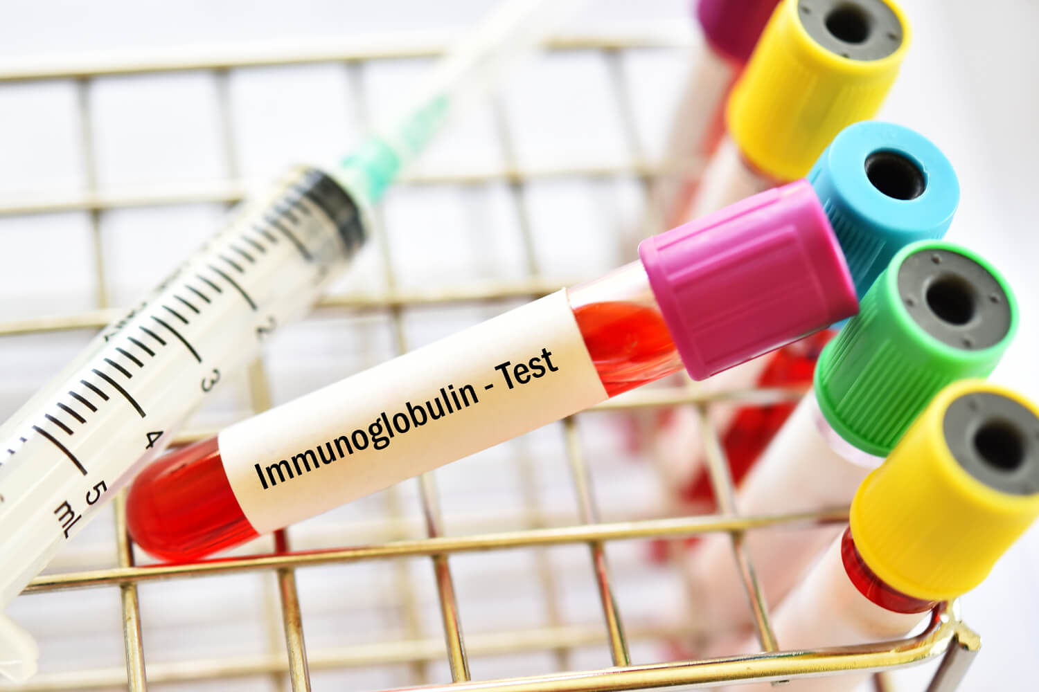 blood test to identify Immunoglobulin level
