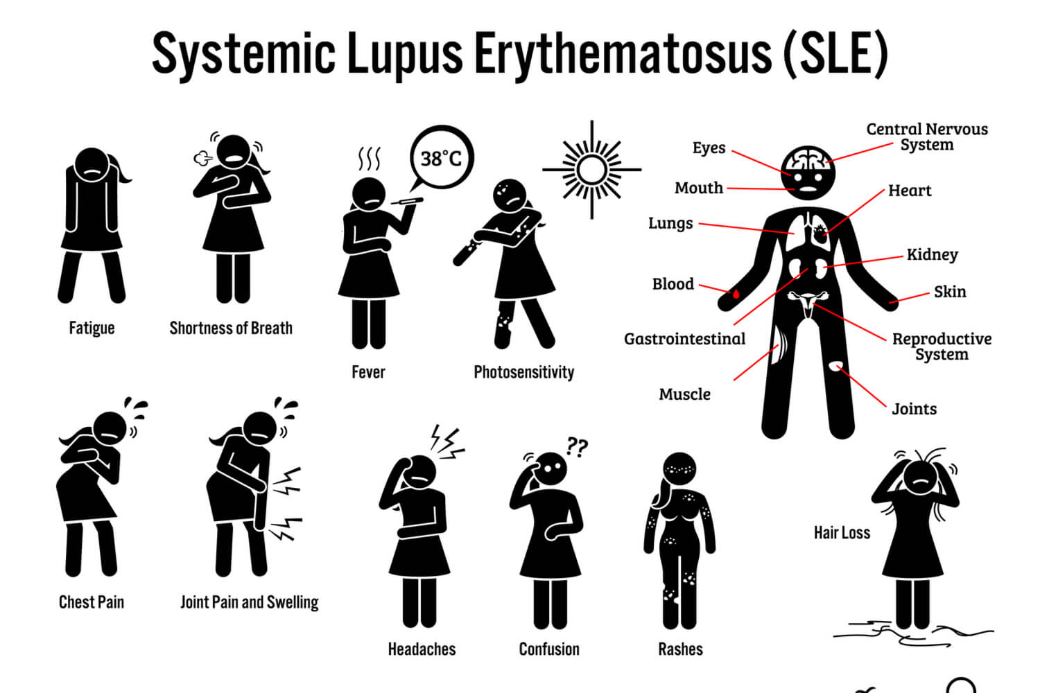 Symptoms of Systemic Lupus Erythematosus