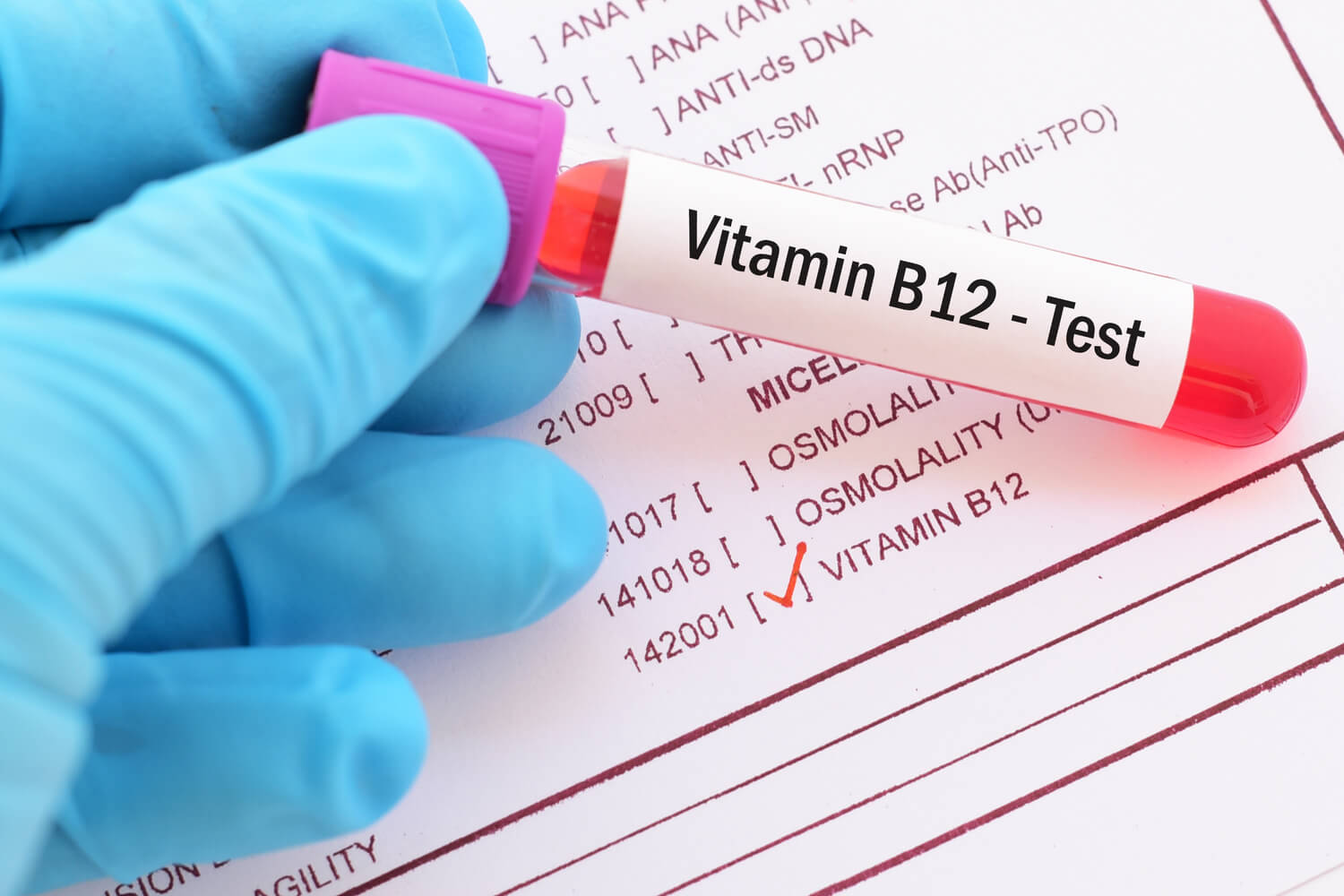 Childhood Vitamin B12 Deficiency Symptoms Diagnosis Prevention Childhood Vitamin B12 Deficiency Symptoms Diagnosis Prevention