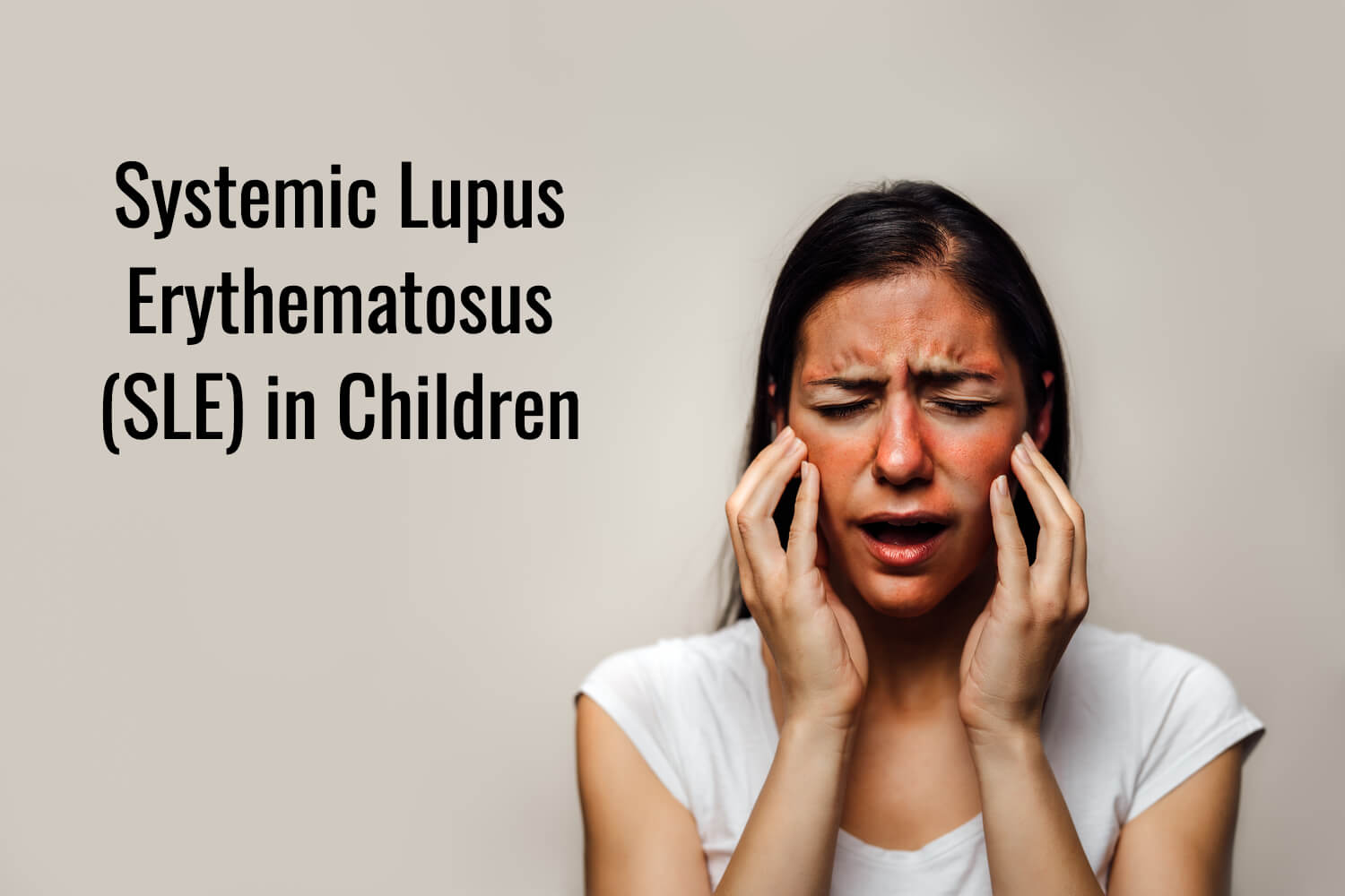 Systemic Lupus Erythematosus(SLE) in Children by Dr. Sagar Bhattad