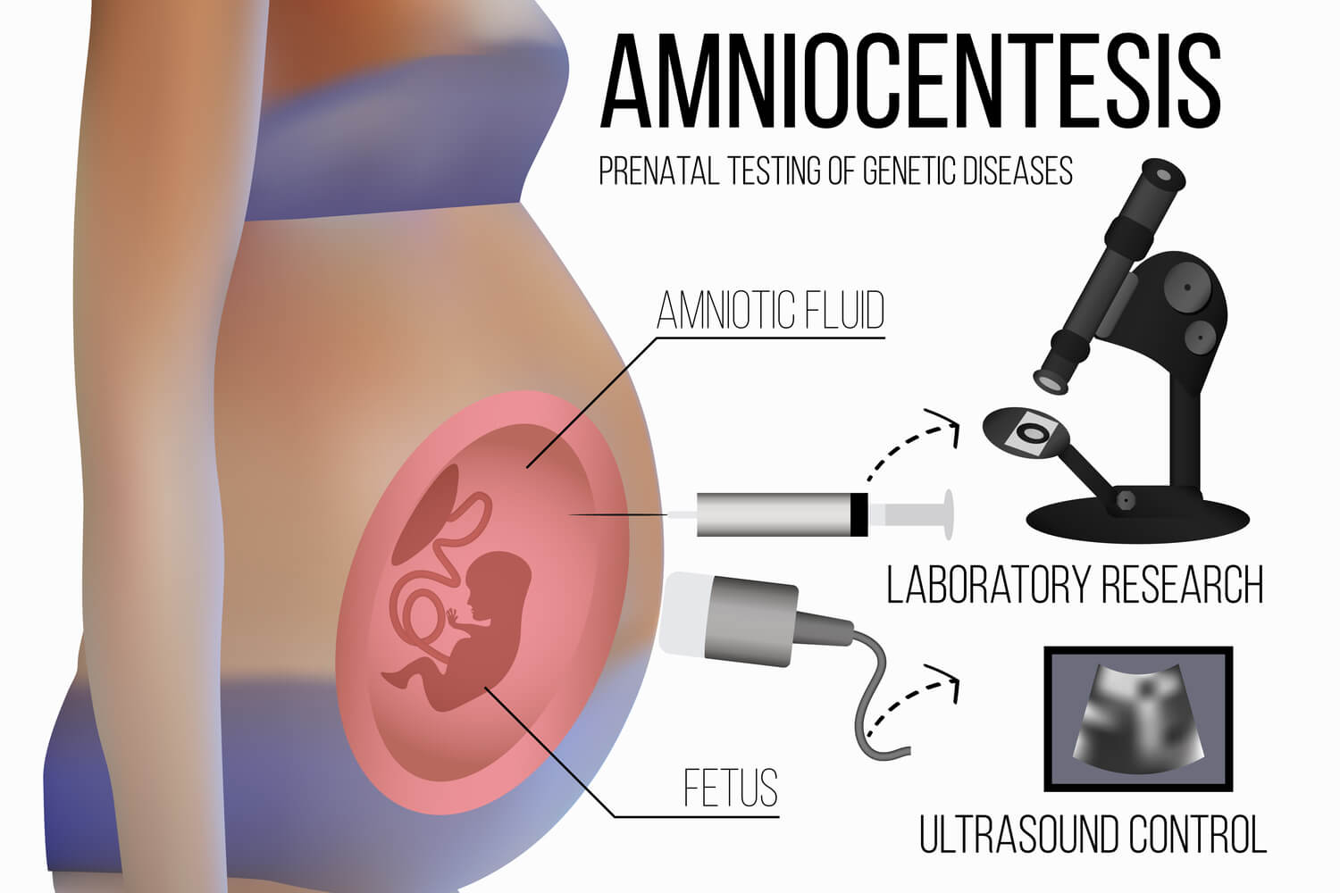amniocentesis test to check genetic isse
