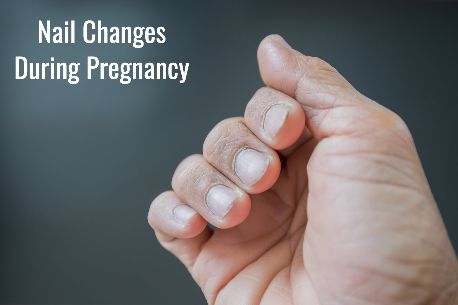 nail changes during pregnancy