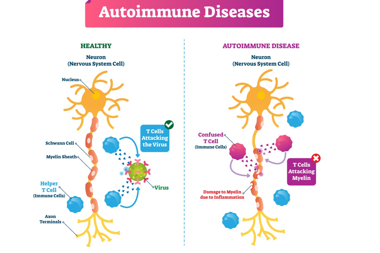 How Do Autoimmune Diseases Work