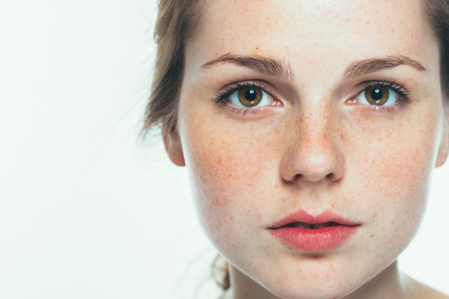 Dealing With Skin Breakouts During Pregnancy Being The Parent