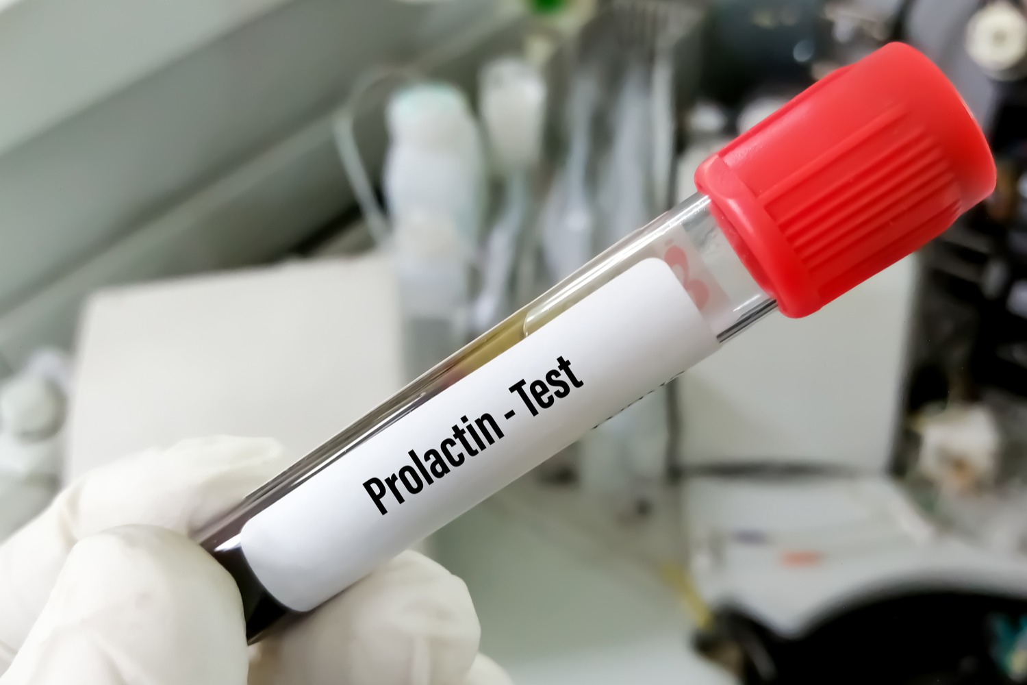 Prolactin Levels Test for Pregnancy