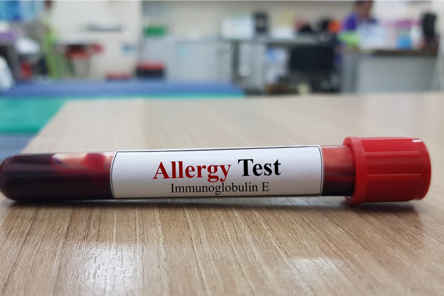Types of Tests Available For Allergies