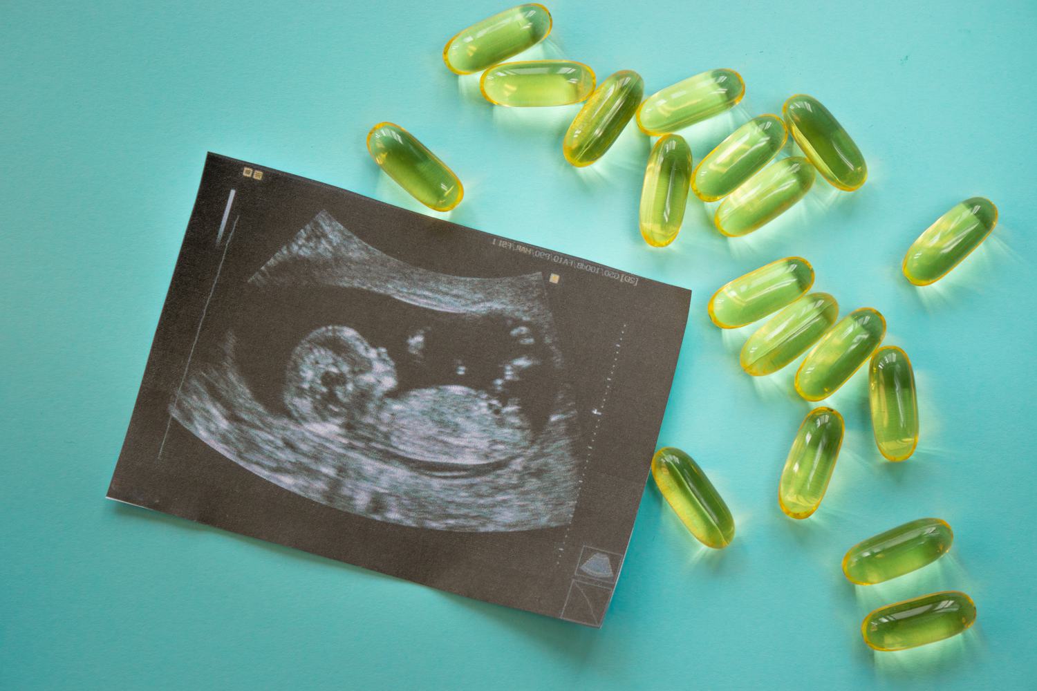 Vitamin E During Pregnancy