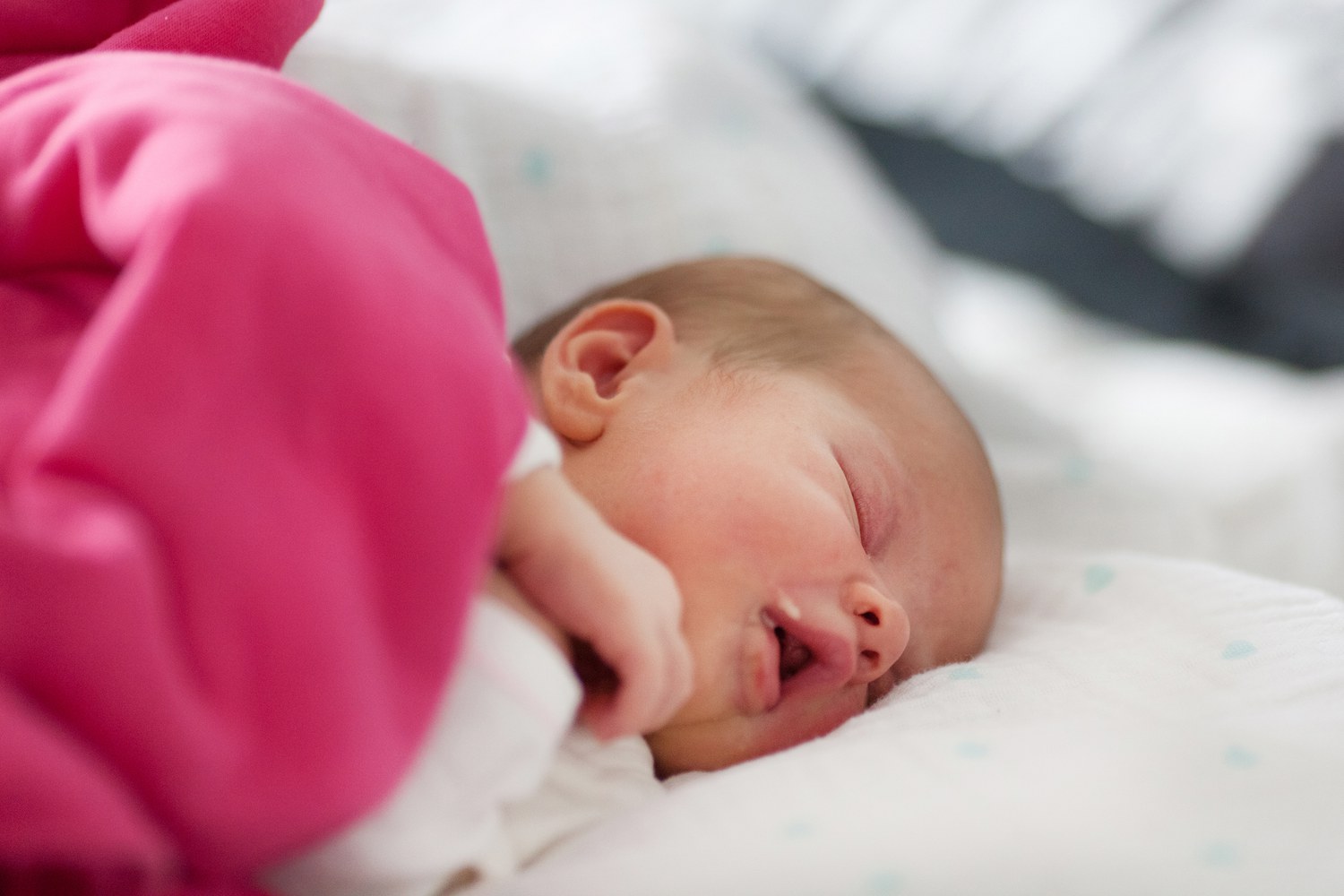 Laryngomalacia In Infants