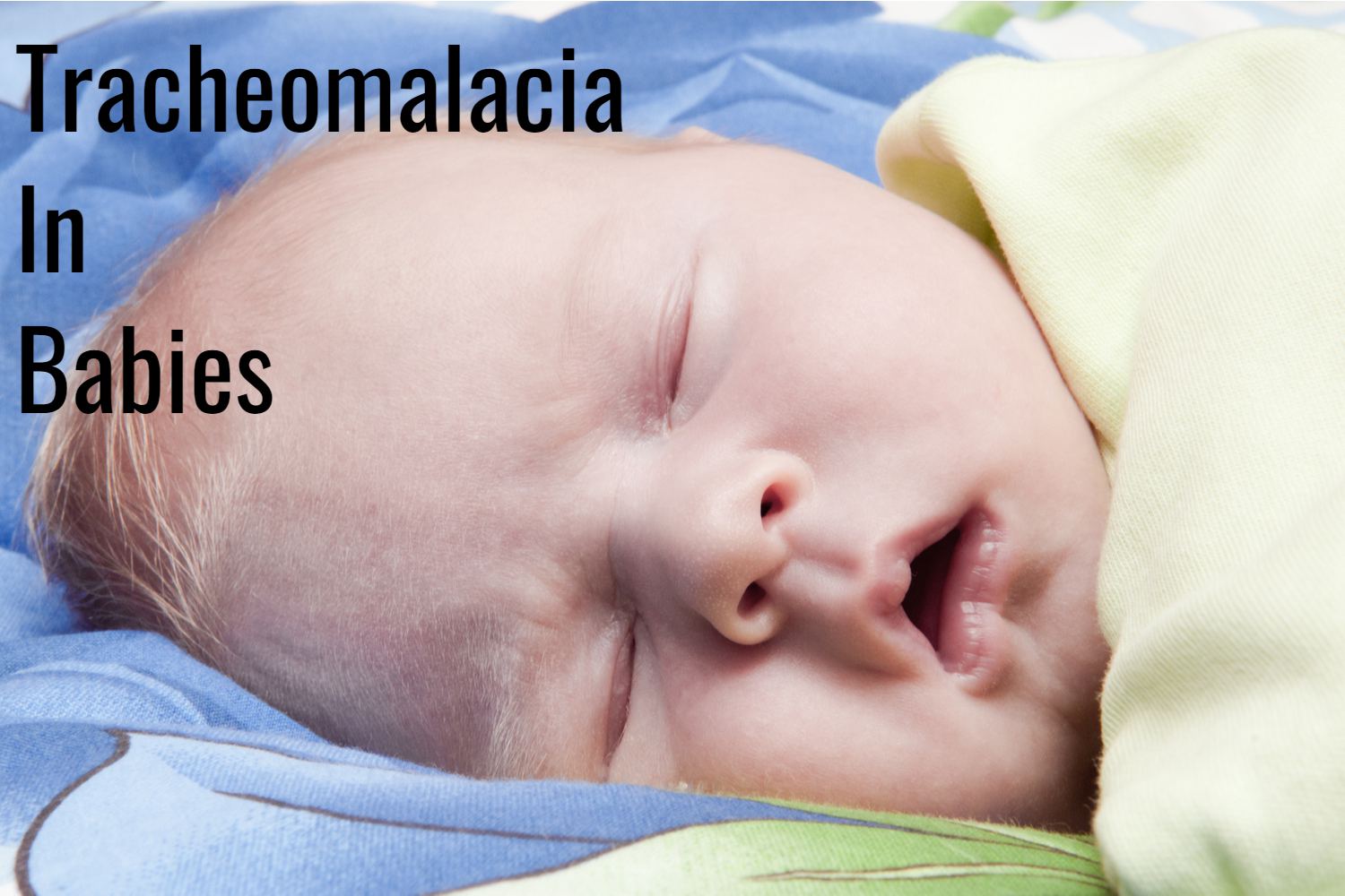 Tracheomalacia in Babies – Symptoms, Diagnosis and Treatment by Dr. Srikanta J T