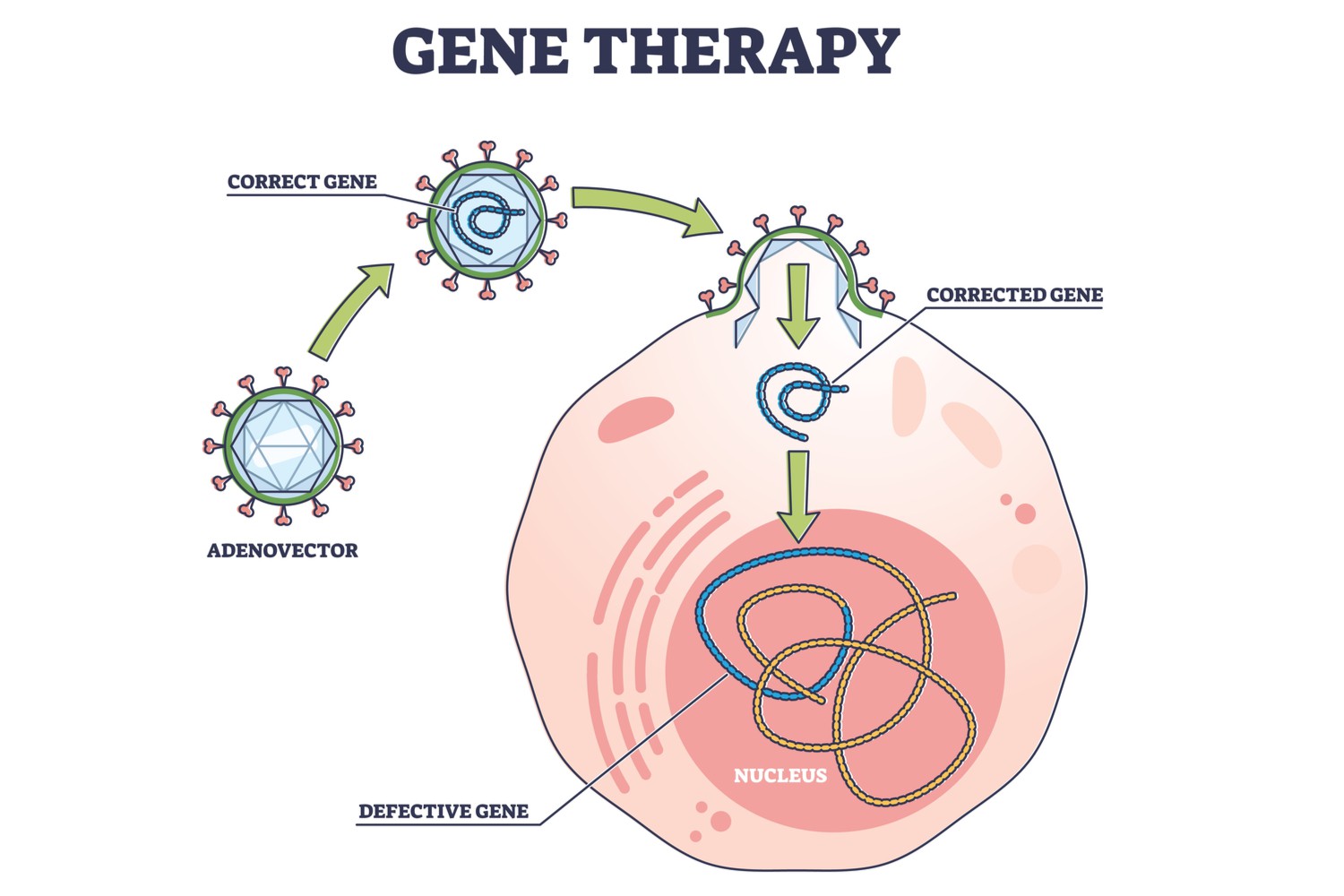 Why is Gene Therapy Done