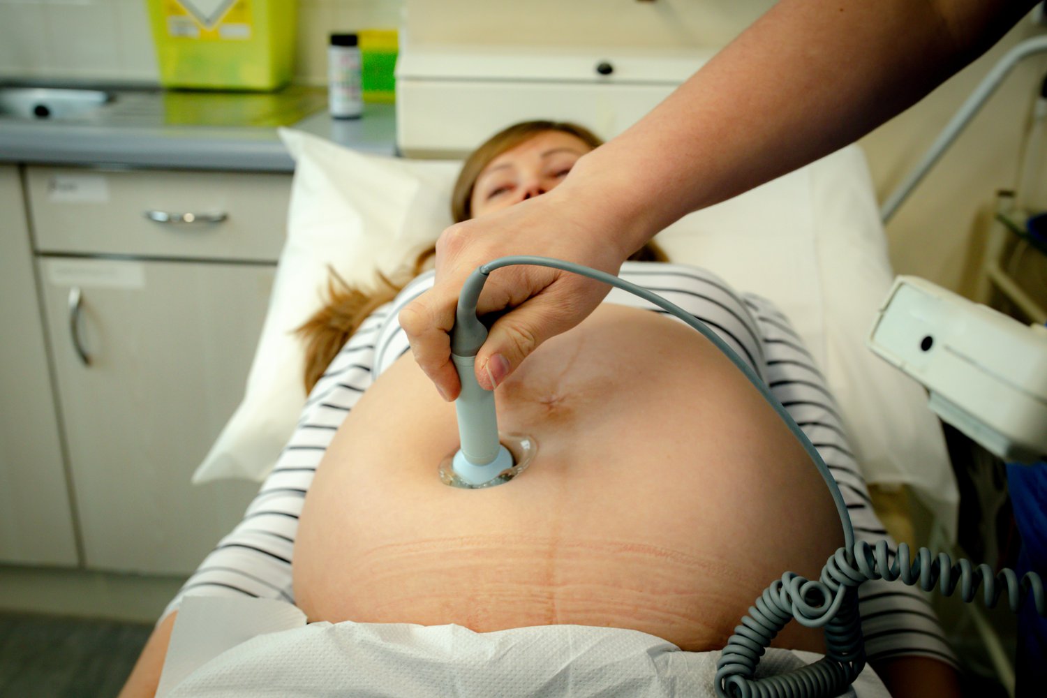 Diagnosis of Fetal Distress