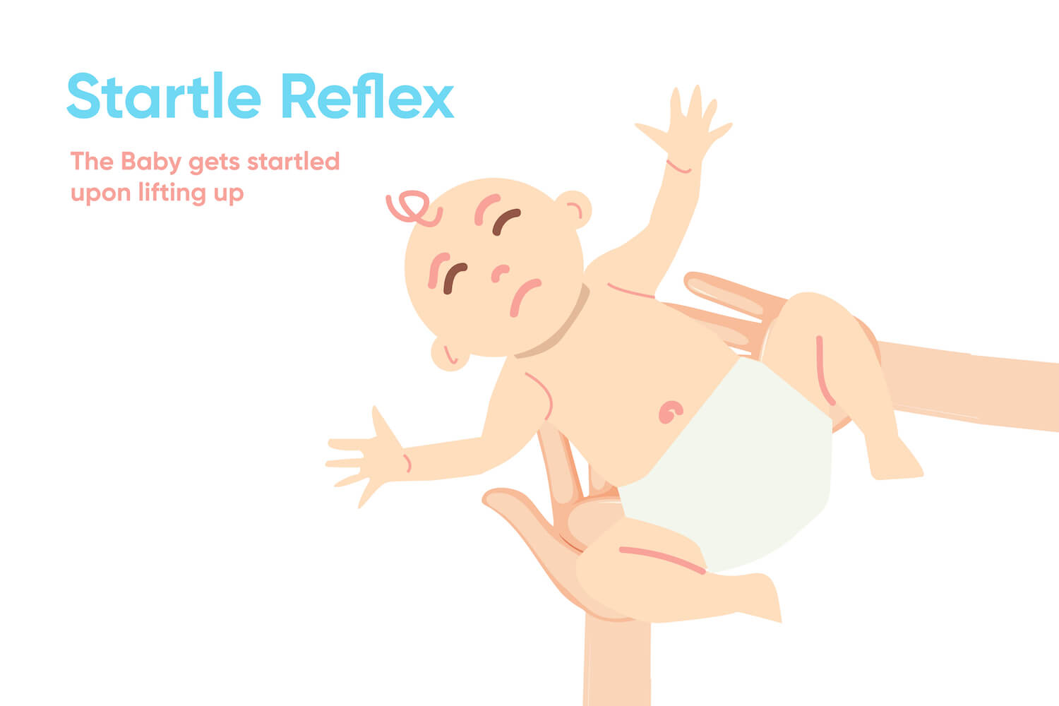 Startle(Moro) Reflex in Babies