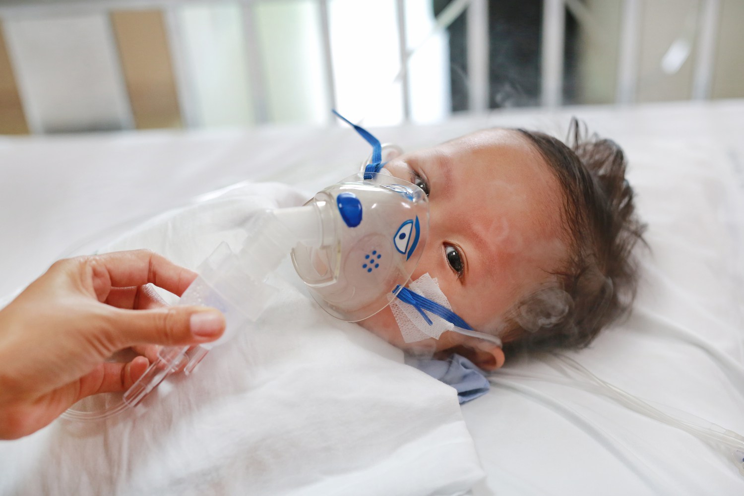 Breathing Problems in Babies Causes, Symptoms, And Treatment Being