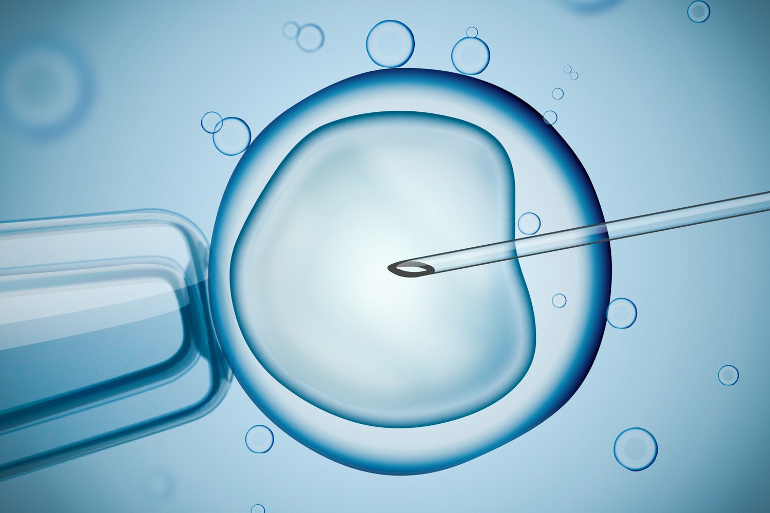 Treatment Options For Secondary Infertility