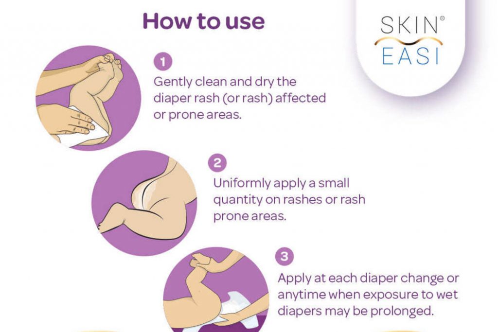 How To Choose The Right Diaper Rash Cream For Your Baby? Being The Parent