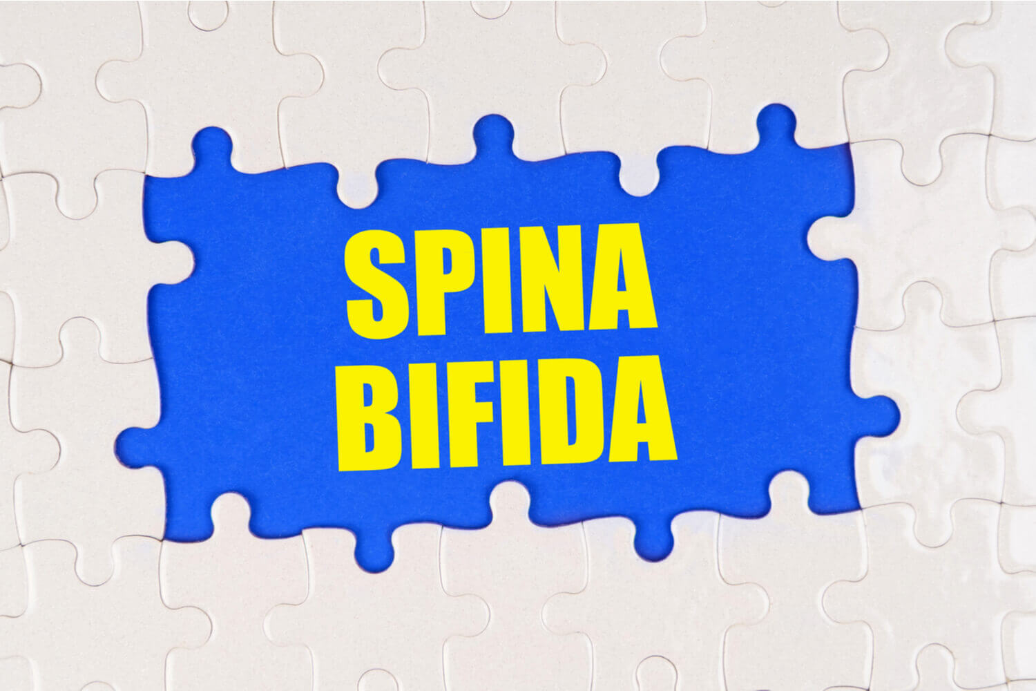 Spina Bifida in Babies