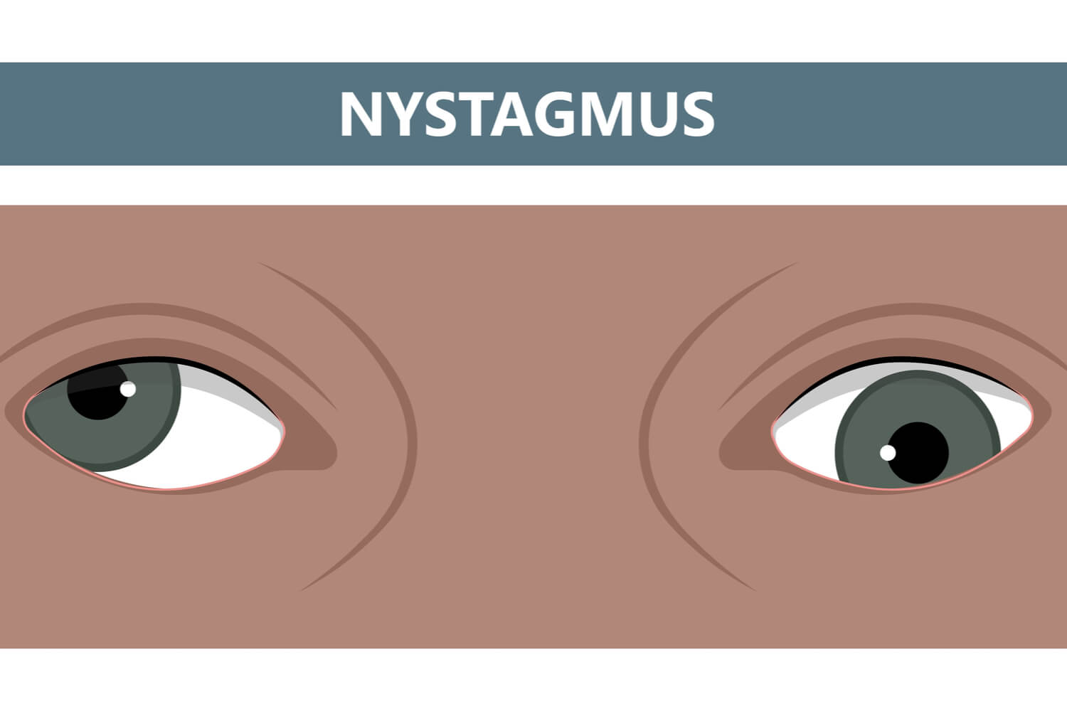 Congenital Nystagmus in Babies Causes, Symptoms And Treatment Being