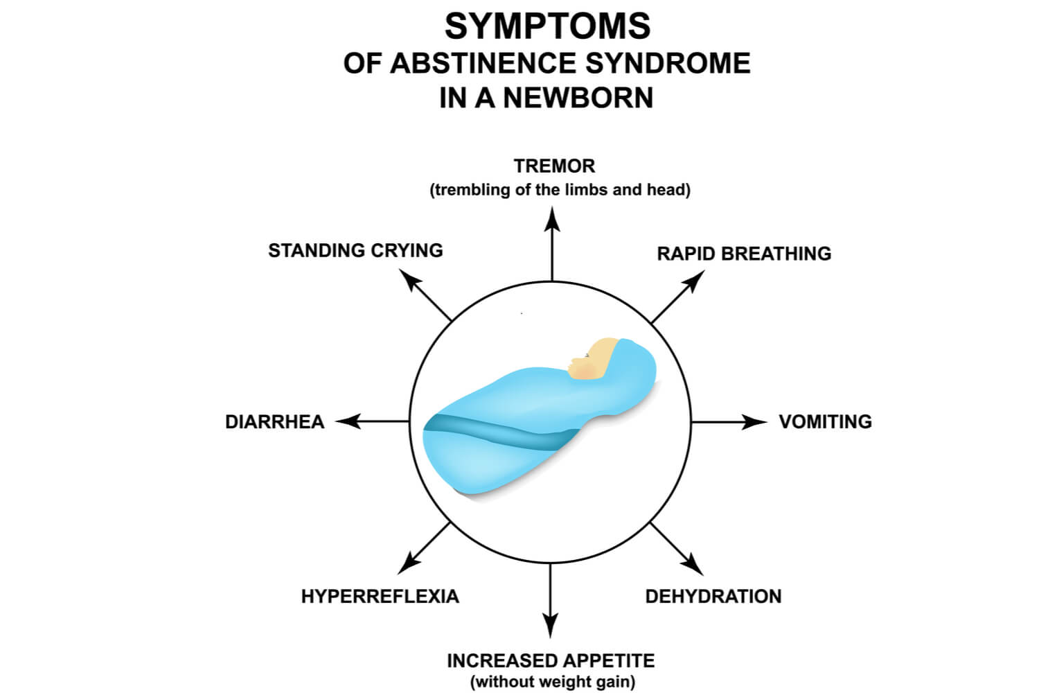 Symptoms of NAS