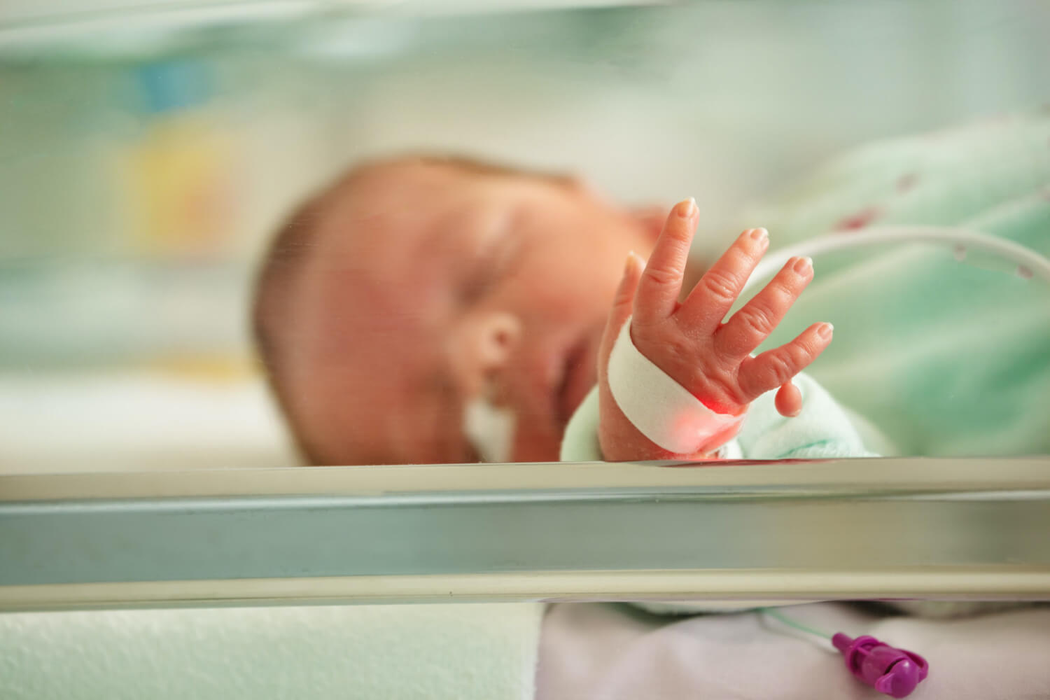 Polydactyly(Extra Fingers) in Babies – Causes, Symptoms And Treatment