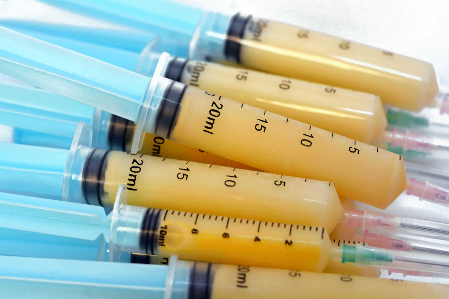 Syringes for feeding breast milk