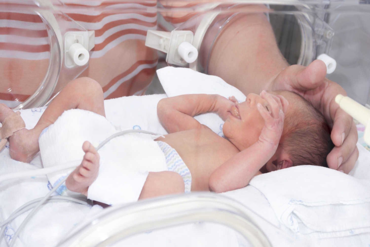 premature baby