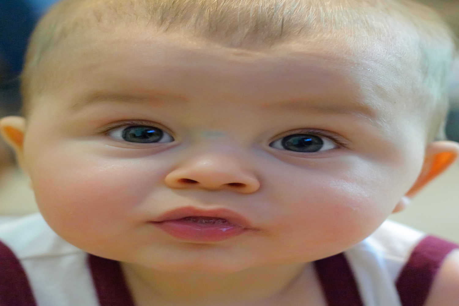 Sugar Bug Vein in Babies