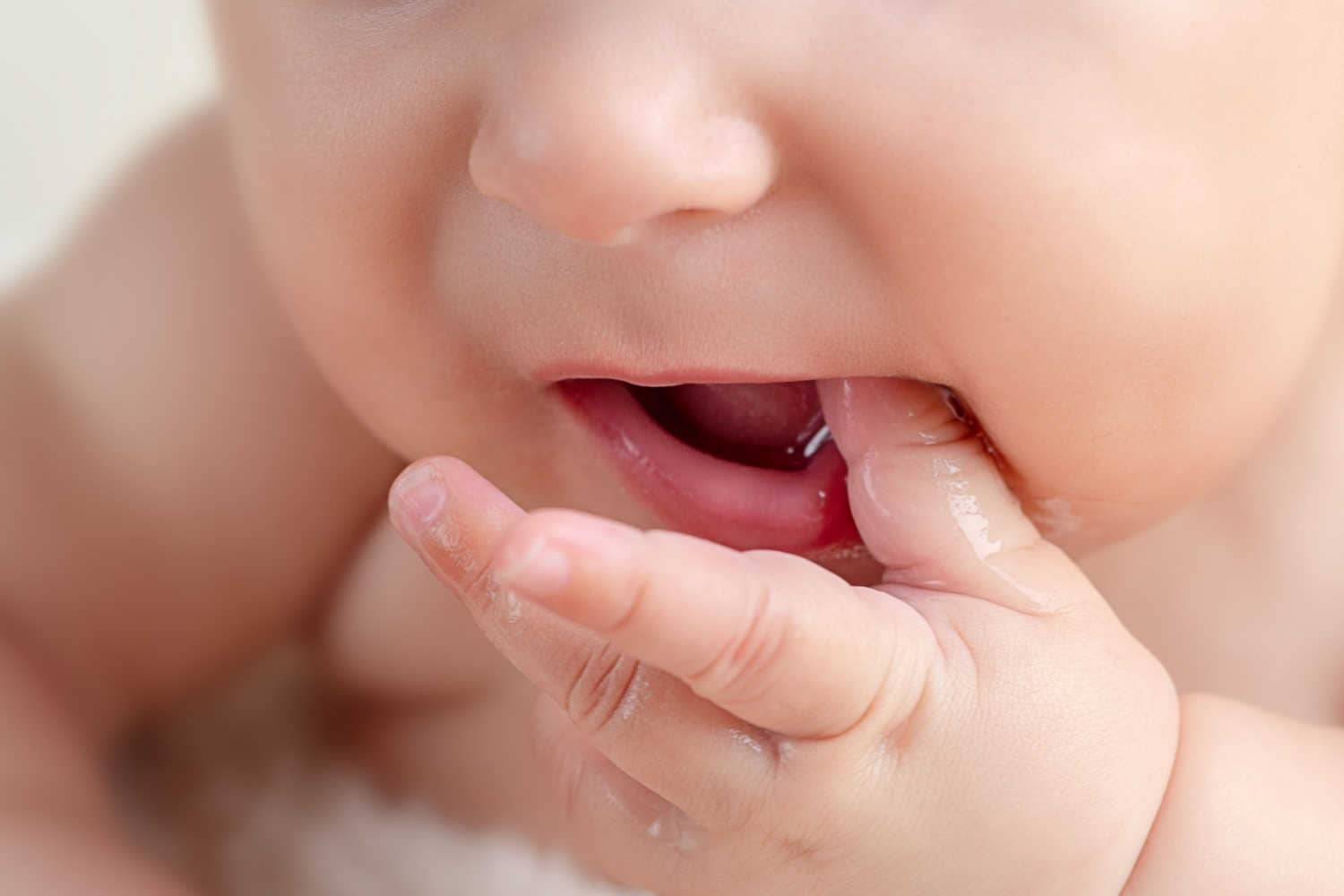 Sore Gums in Babies – Top Causes and Precautions