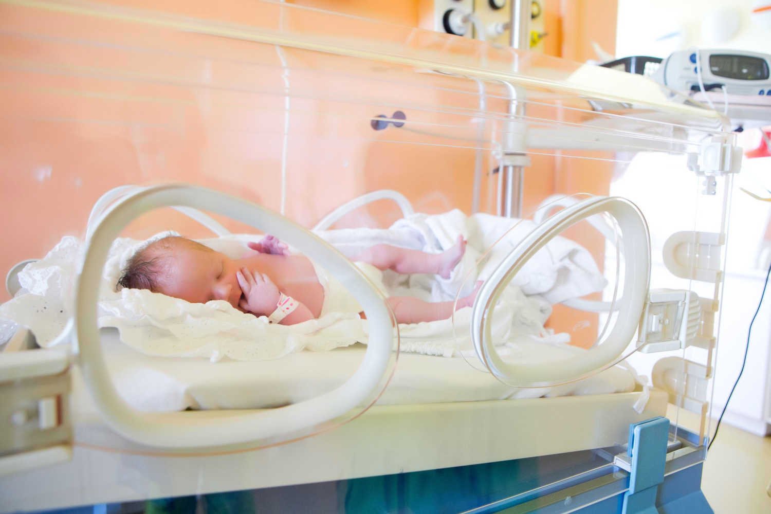 Risk Factors For NEC in Babies