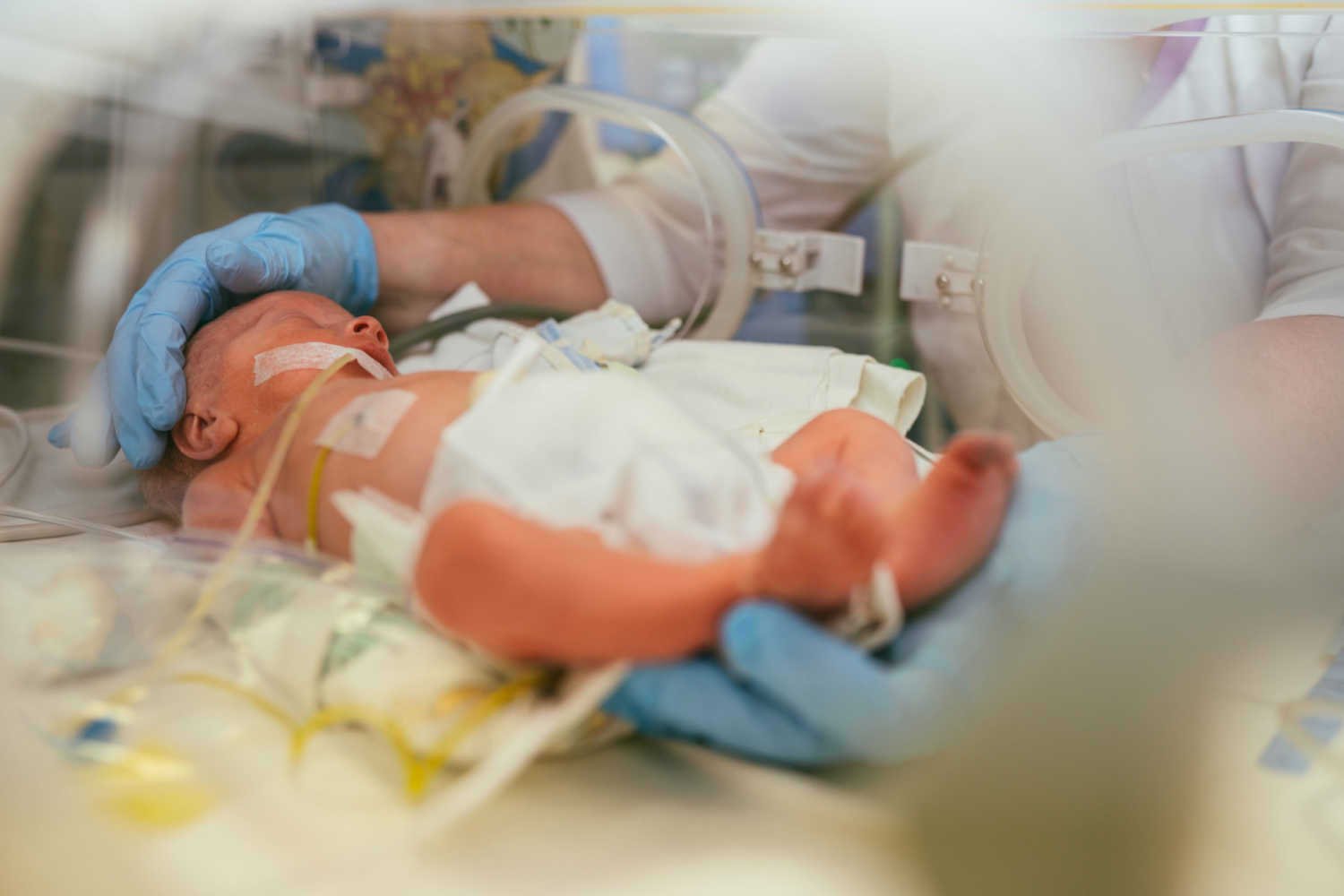 Treatment of Necrotizing Enterocolitis in Babies