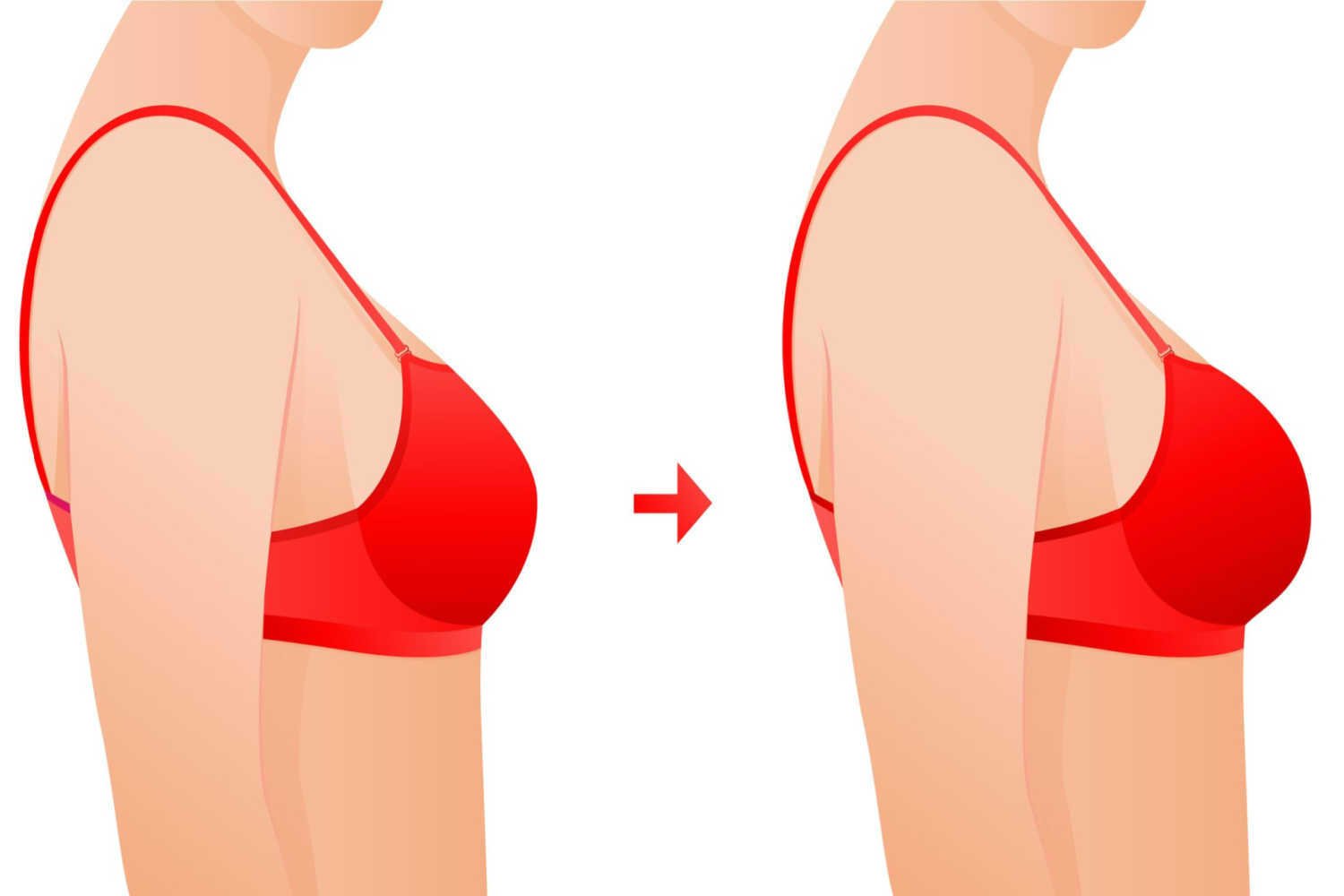 Breastfeeding Affect Breast Size