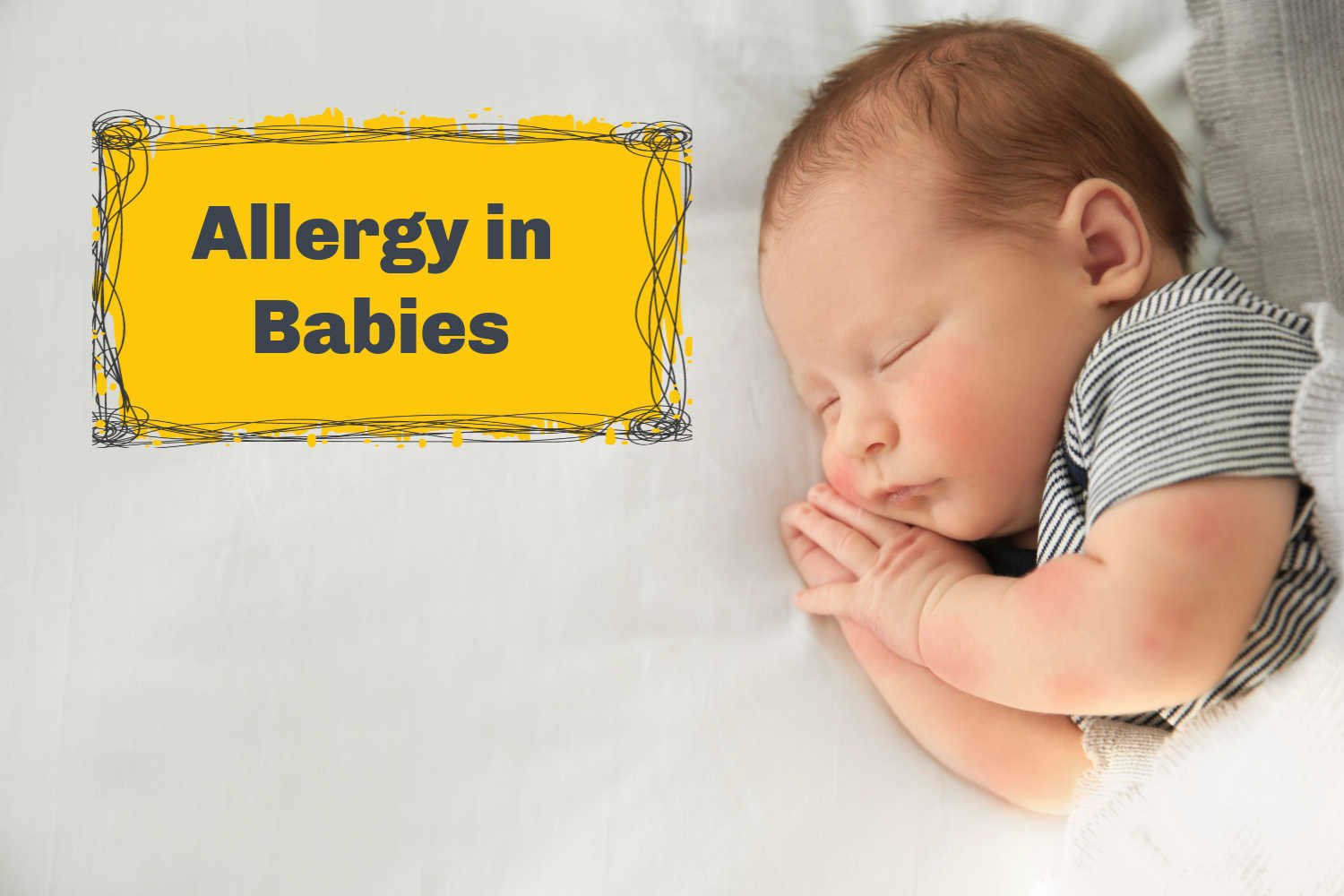 Allergies in Babies Causes, Diagnosis and Treatment Being The Parent