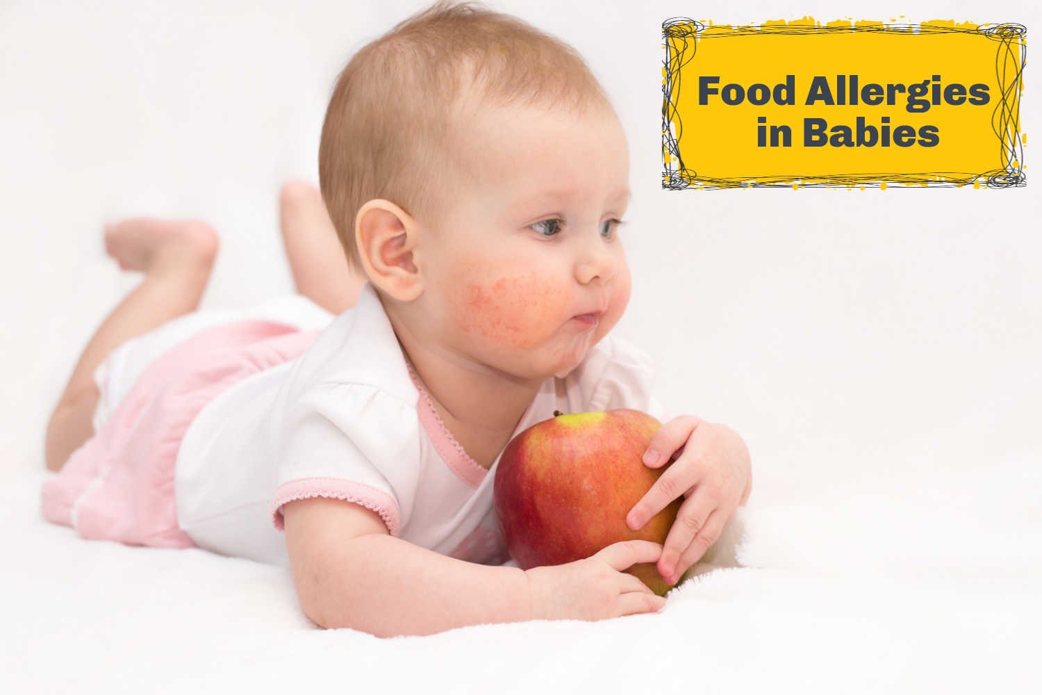 Food Allergies in Babies- Signs, Preventive Measures and Treatment
