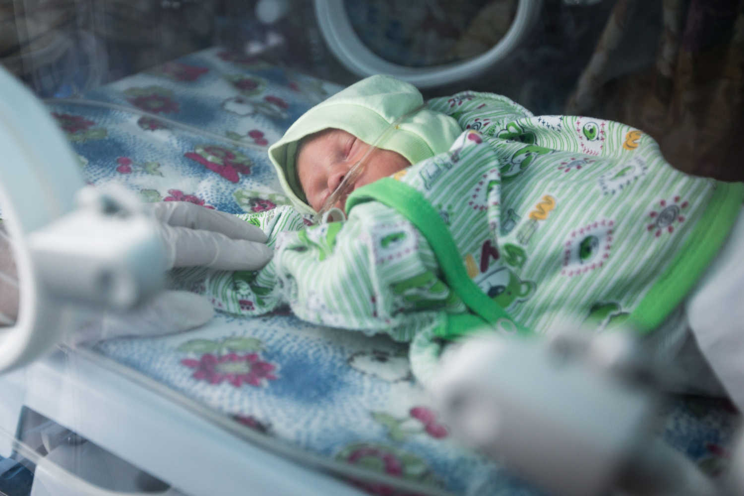 Birth Defects Are Caused by Hyperthyroidism and Hypothyroidism?