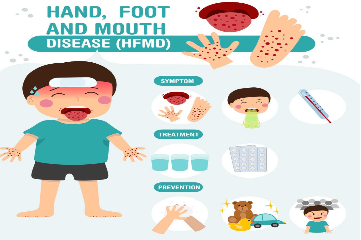 symptoms of HFMD